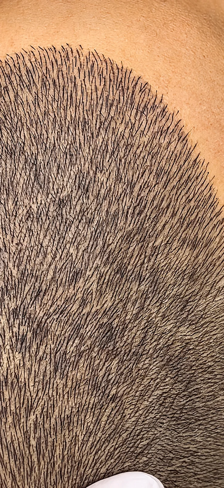 Close-up of hair strokes at the edge of a short-cropped hairline