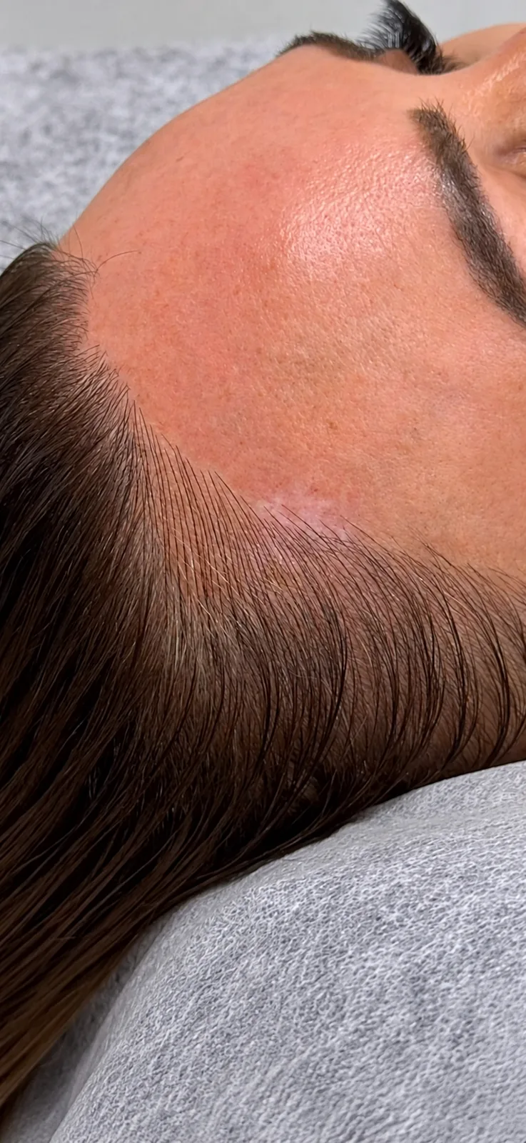 Side view of a woman's temple and hairline with strokes set between the existing hairs