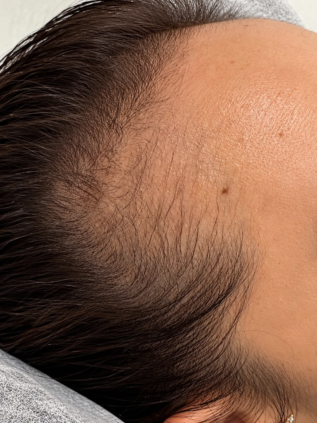 A thinning temple area with fine pigment strokes angled like the surrounding hair